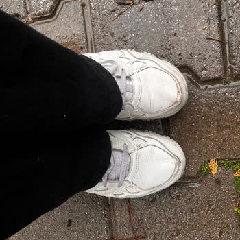 Skechers Hillcrest Ayakkabısının Kısa Sürede Deformasyonu Ve Garanti Reddi