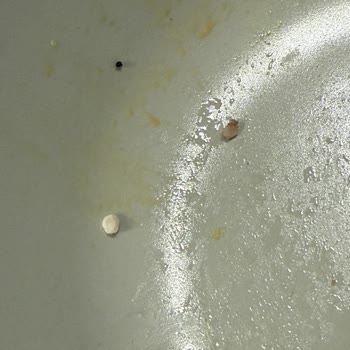 Migros Uzman Kasap Hamburger Köftesinde Kemik Parçası Çıktı, Diş Dolgusu Ağrıya Sebep Oldu