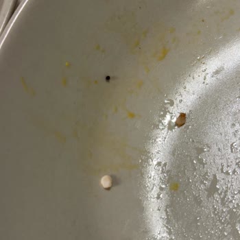 Migros Uzman Kasap Hamburger Köftesinde Kemik Parçası Çıktı, Diş Dolgusu Ağrıya Sebep Oldu