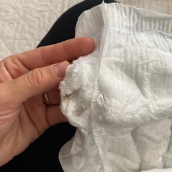 Molfix Bebek Bezi İçindeki Sert Kahverengi Pamuklu Parçalar Hakkında Güvenlik Endişesi