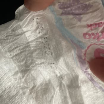 Molfix Bebek Bezi İçindeki Sert Kahverengi Pamuklu Parçalar Hakkında Güvenlik Endişesi