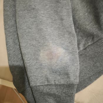 Dr. Beckmann Leke Canavarı Kazağımı Mahvetti!