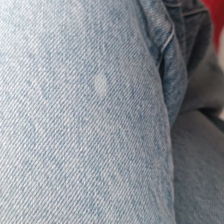 Mavi Pantolonda Çıkarılamayan Beyaz Leke Ve Kalite Sorunu