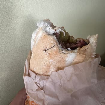 Köfte Ekmekte Tel Parçası Bulunması Sağlık Riski Ve Trendyol’dan Cevapsızlık