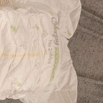 Sleepy 2 Numaralı Mini Bebek Bezinde Eksik Ön Uzantı Ve Sızma Problemi