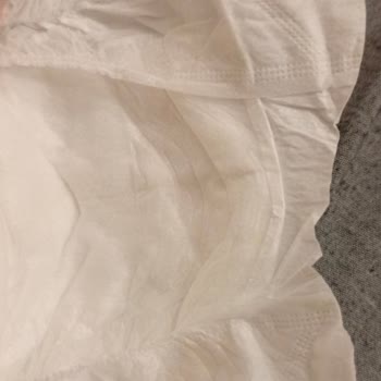 Sleepy 2 Numaralı Mini Bebek Bezinde Eksik Ön Uzantı Ve Sızma Problemi