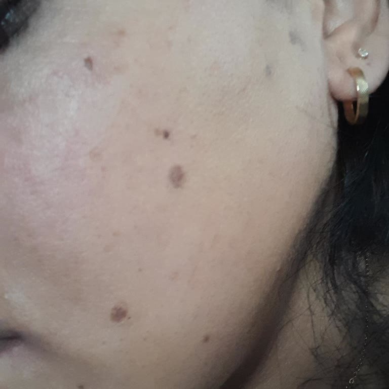 Bazekol Sada Hastanesi İşlem Memnuniyetsizliği