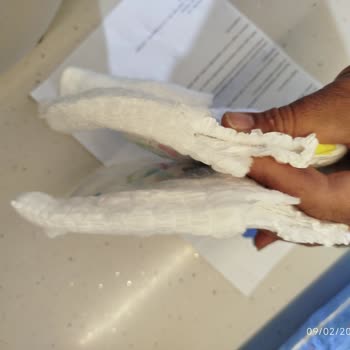 Molfix 4 Numaralı Külot Bezlerde Aşırı Sızıntı Ve Kalite Sorunu