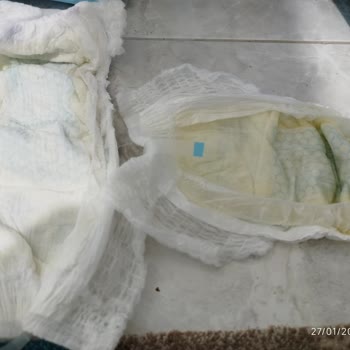 Molfix 4 Numaralı Külot Bezlerde Aşırı Sızıntı Ve Kalite Sorunu