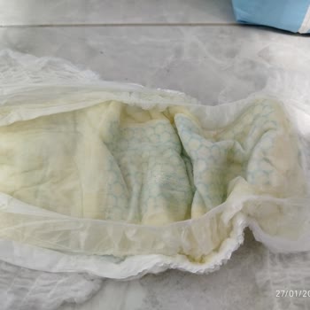 Molfix 4 Numaralı Külot Bezlerde Aşırı Sızıntı Ve Kalite Sorunu