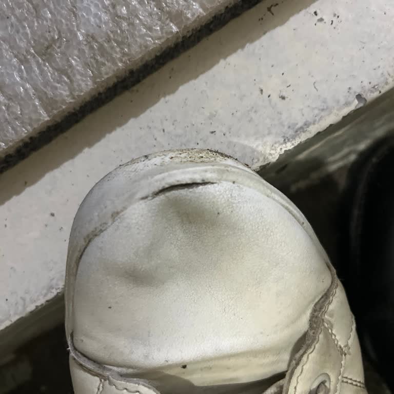 Kısa Sürede Açılan Ayakkabı Önü İçin Değişim Talebi