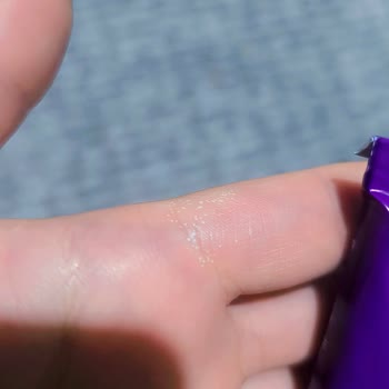 Koleston 09 Sarı’da Cilt Yanması Ve Boya Etkisizliği