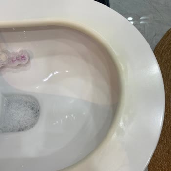 Terra Asma Klozet Kapak Sararması Ve Silikon Parçalarının Tuvalete Düşmesi