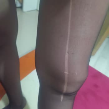 Penti Manisa Şubesindeki Jartiyer Çorapların Sürekli Kaçması Ve Destek Eksikliği