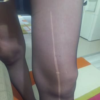 Penti Manisa Şubesindeki Jartiyer Çorapların Sürekli Kaçması Ve Destek Eksikliği