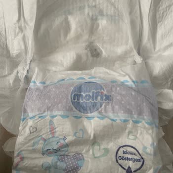 Molfix Bebek Bezinde Siyah Lekeler: Hijyen Ve Kalite Kontrol Talebi