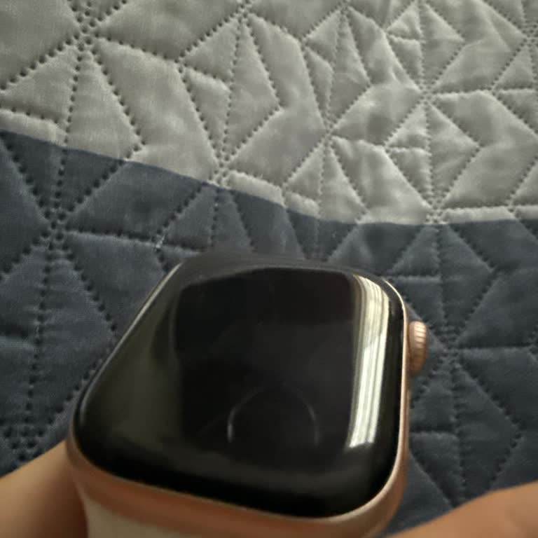 Apple Watch 10 Camı Çabuk Çizildi, Garanti Servisi Reddedildi