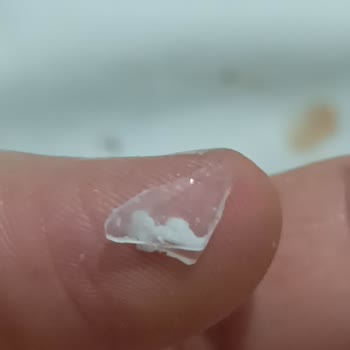 Enka Süt Peynirinde Keskin Plastik Parça Bulunması