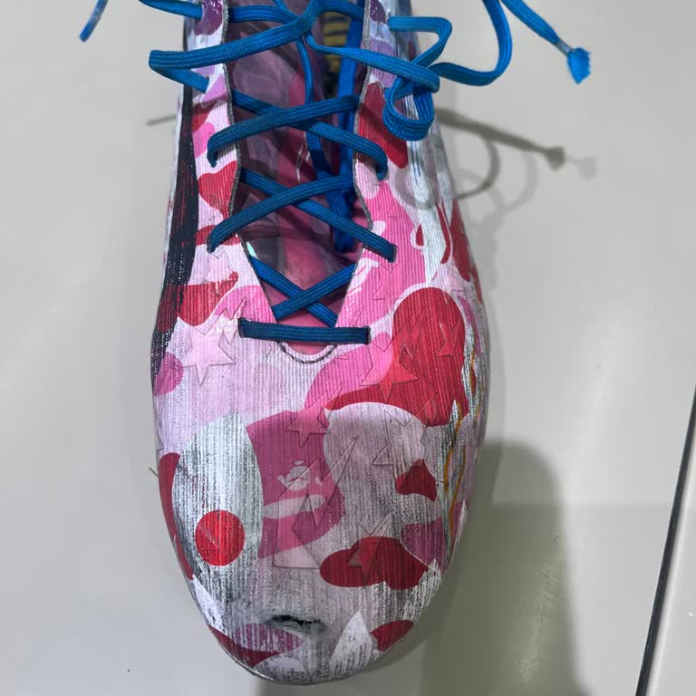 15.000 TL’lik Kramponun 10 Kullanımda Yırtılması Ve Tüketici Hatası İddiası