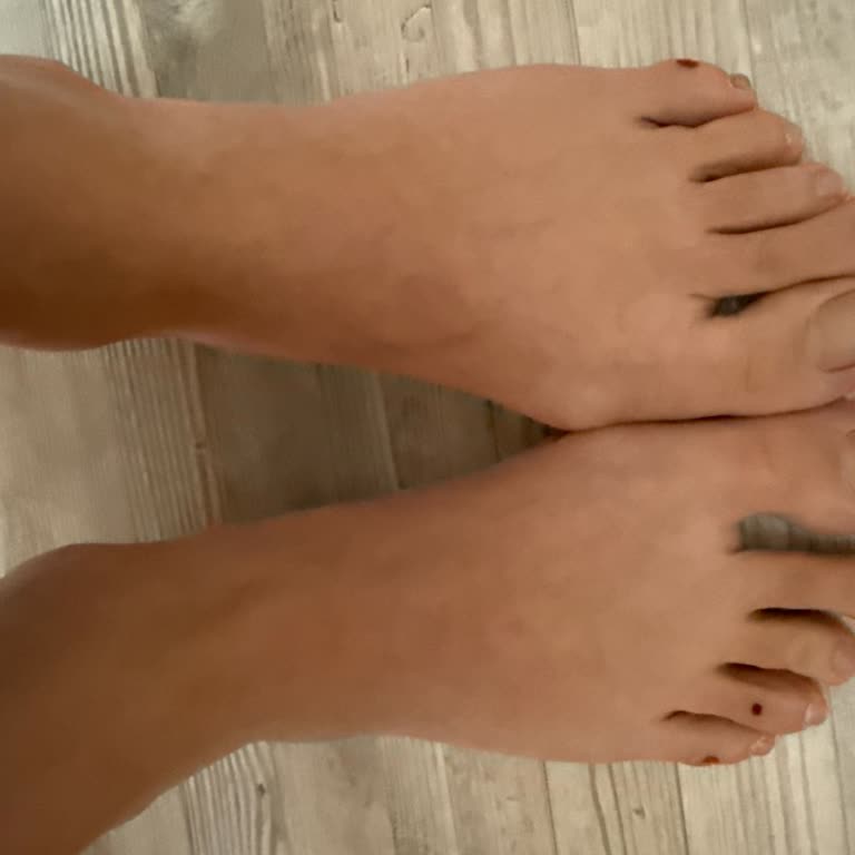 Ağrılı Yara Ve Çorap Yıpratmaya Neden Olan Çizme Tasarımı İçin İade Talebi