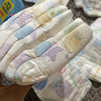 Molfix’te Kullanılmış Bezlerin Yeniden Satılması