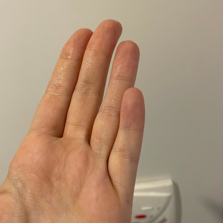 Waterproof Özelliği Çalışmayan Skechers Bot İçin Ücret İadesi Talebi