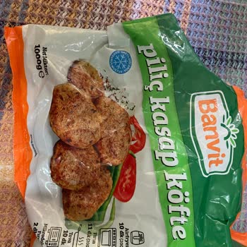 Banvit Köfte İçindeki Taş Diş Ve Ağız Sağlığını Tehlikeye Atıyor!