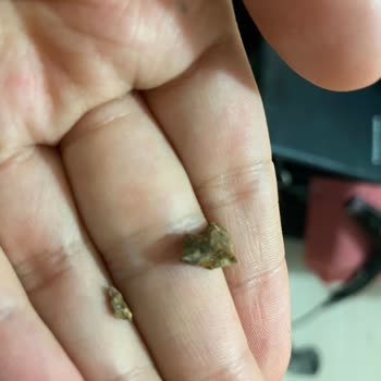 Banvit Köfte İçindeki Taş Diş Ve Ağız Sağlığını Tehlikeye Atıyor!