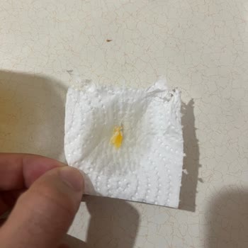 Dimes Marka Ananas Suyunda Küf Sorunu: Ürün Güvenliği Ve İade Talebi