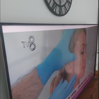 Servis Müdahalesi Sonrası Oluşan Hasarın Garanti Kapsamına Alınması Ve Ücretsiz Onarım Talebi