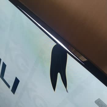 Teknik Servis Çalışanı Televizyonu Düşürdü, Bayi Ve Digiturk Geri Dönüş Yapmadı