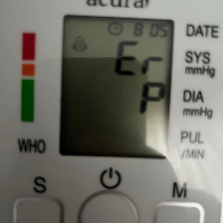 Acura AC463 Tansiyon Aleti Ölçüm Yapmıyor Ve Garanti Kapsamında Yardım Bulamıyor