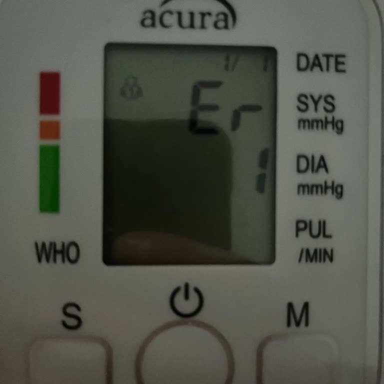 Acura AC463 Tansiyon Aleti Ölçüm Yapmıyor Ve Garanti Kapsamında Yardım Bulamıyor