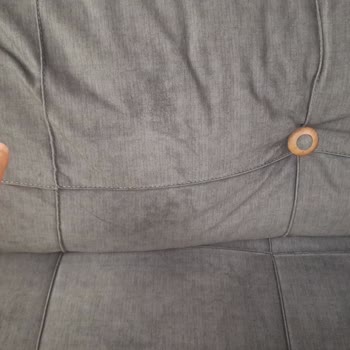 Düğme Kopması Ve Kısa Süreli Servis Randevu Planlaması Şikayeti