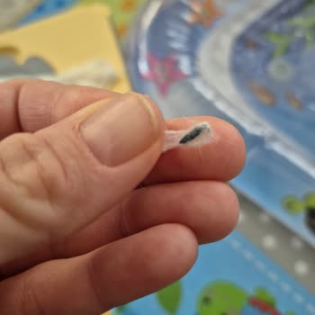 Bebek Temizleme Pamuğunda Fare Dışı Cisim Bulundu Sağlık Endişesi Ve Acil İnceleme