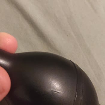 19 Ay Sonra Yırtılan Pektus Pompası İçin Garantinin Olmadığı Söylenmesi