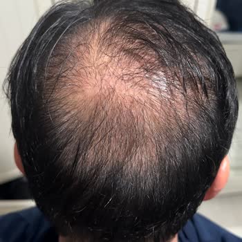 Esteworld Tutarlı Konuşmuyor Ve İlgisiz