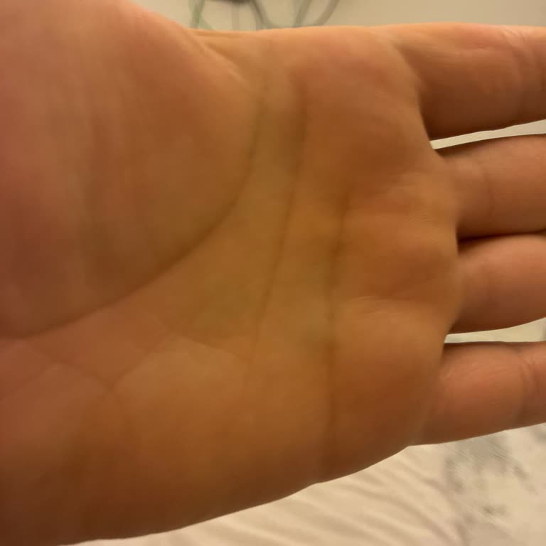 HepsiJet Kuryesinin Teslim Etmemesi Ve Müşteri Hizmetlerinin İlgisizliği