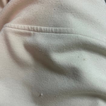 Instagram’da Satın Aldığım Ürün Tüylendi, 15 Gün Sonra Yardım Gelmedi