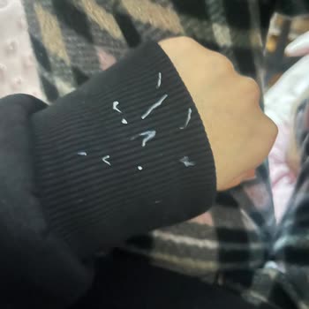 Oral - B Diş Macunu Ağzımda Soyulmalara Neden Oldu!