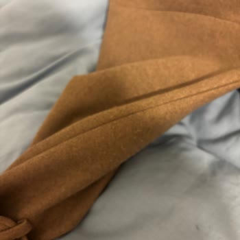 Kısa Sürede Pörsüme Ve Tüylenme Gösteren Kaban Ücret İadesi Talebi