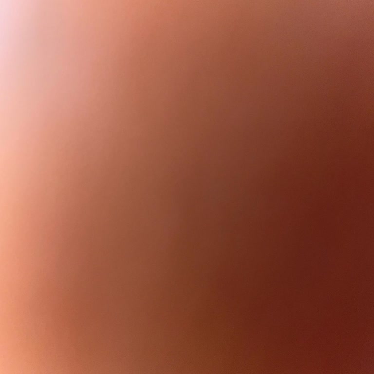 Çarşaflarda Tüylenme Ve İade Sürecindeki Yanıltıcı Ret Kararı