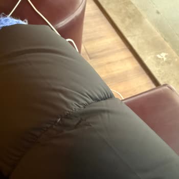 Montta Kaz Tüyleri Çıkması Ve Dikiş Sorunu