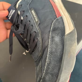 Tommy Hilfiger Ayakkabısında Boya Akması Ve Boyner’in Yetersiz Çözümü
