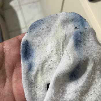 Tommy Hilfiger Ayakkabısında Boya Akması Ve Boyner’in Yetersiz Çözümü