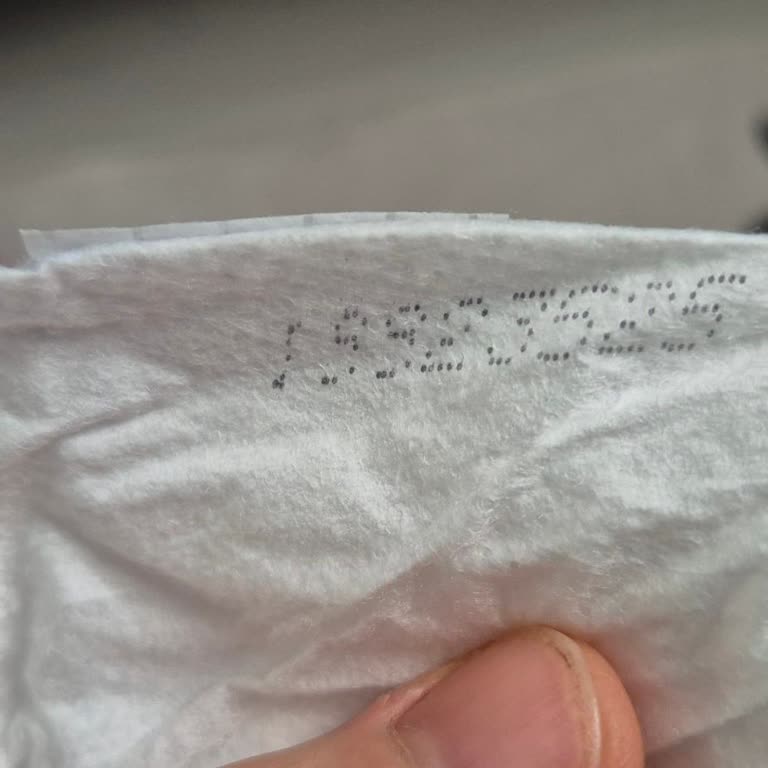 Molfix Bebek Bezinde Sorunlu Paketten Şiddetli Pişik, Hızlı Çözüm Ve Özür Bekliyorum