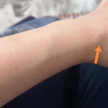 Samsun Medical Park Hastanesinde Kötü Muamele Ve MR Makinesi Arızasıyla Yaşanan Travma