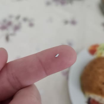 Yunus Market Şubesinde Ekmeğe Karışan Metal Parçası Ciddi Sağlık Riski