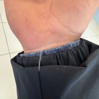 Tüy Dökülen Mont İçin İade Talebi