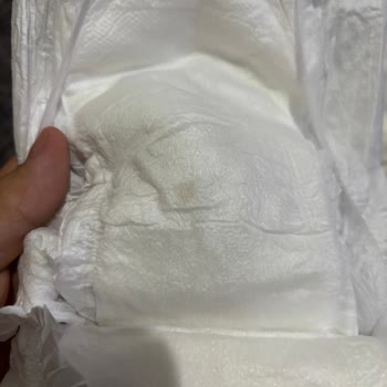 Sleepy Bebekte Yapışkan Silikon Parçaları Bulunması Sağlık Endişesi